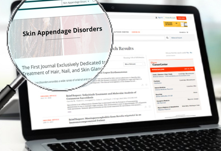 Artículos Científicos 3 Skin Appendage Disord