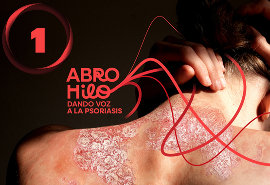 Caso clínico 1: Tildrakizumab: una mano amiga para la piel y el intestino 3 Slidekit Abro hilo 1