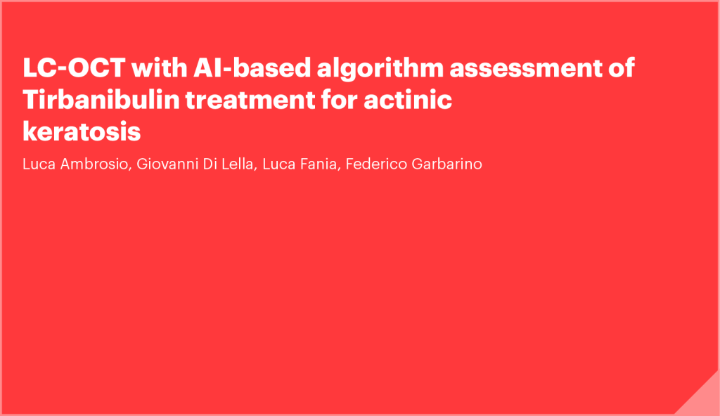 LC-OCT with Al-based algorithm assessment of Tirbanibulin treatment for actinic keratosis
