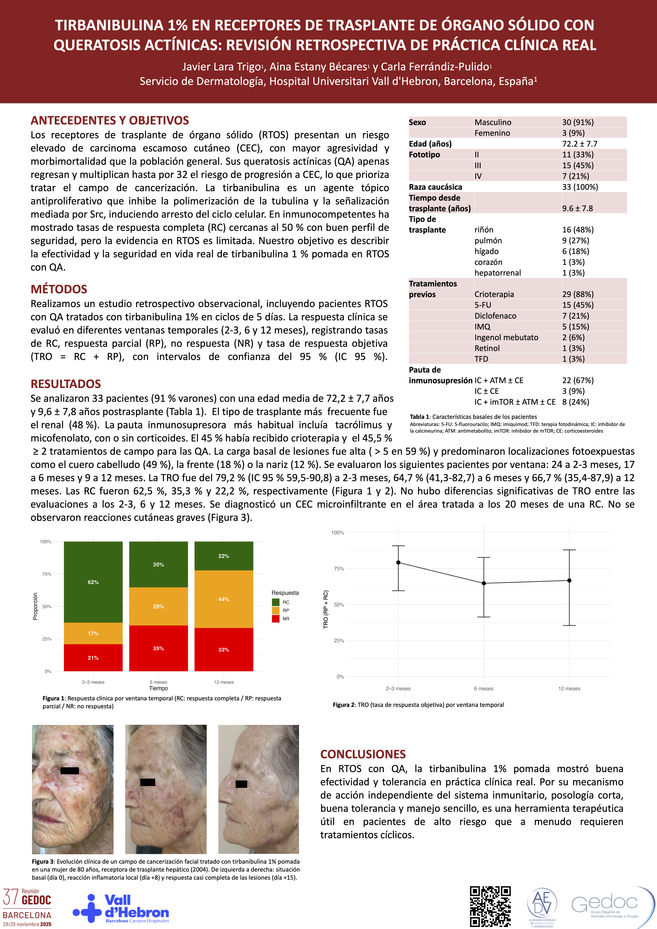 Tirbanibulina1% en receptores de trasplante de órgano sólido con queratosis actínicas