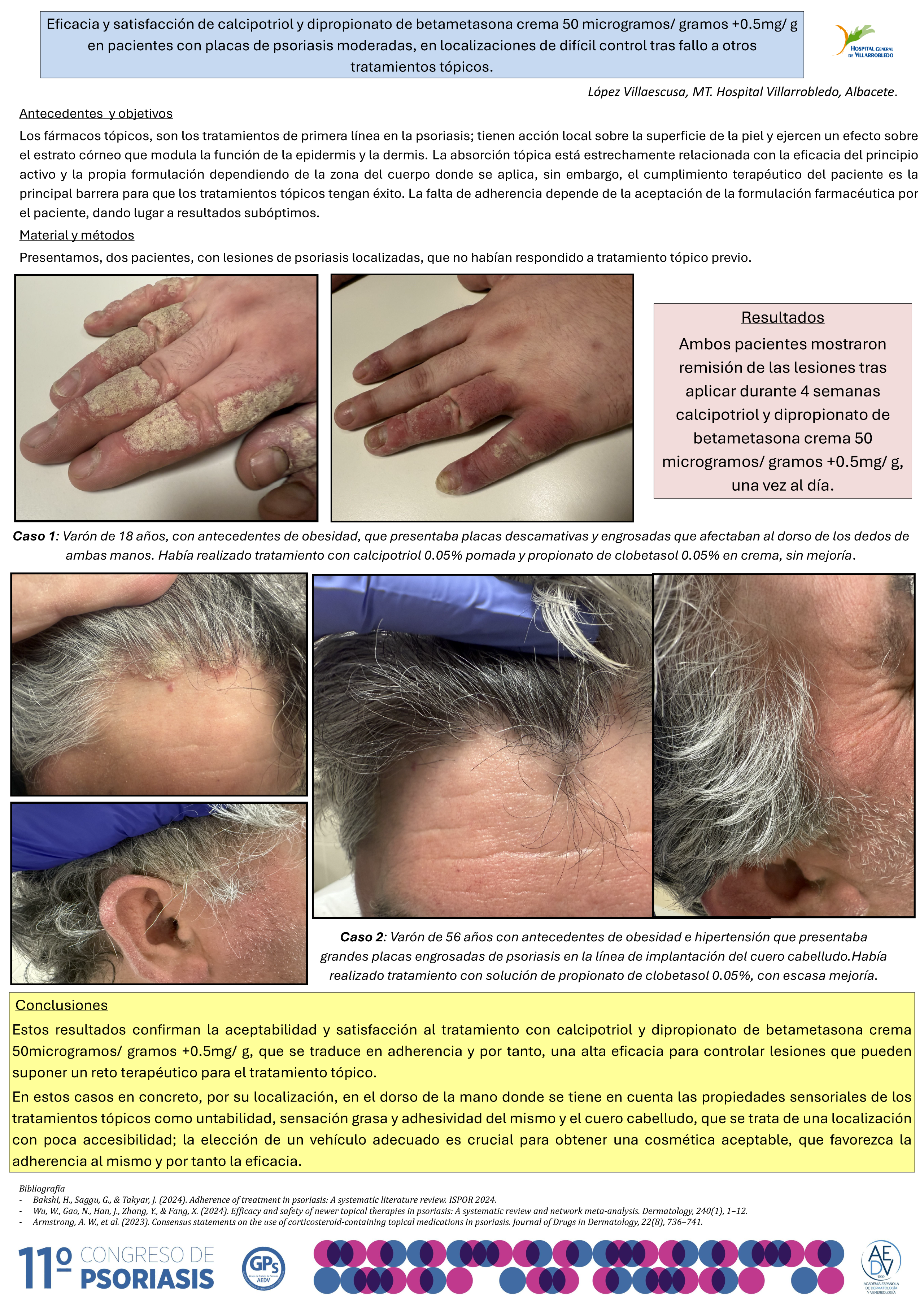 Eficacia y satisfacción de calcipotriol y dipropionato de betametasona crema 50 microgramos/ gramos +0.5mg/ g en pacientes con placas de psoriasis moderadas, en localizaciones de difícil control tras fallo a otros tratamientos tópicos.