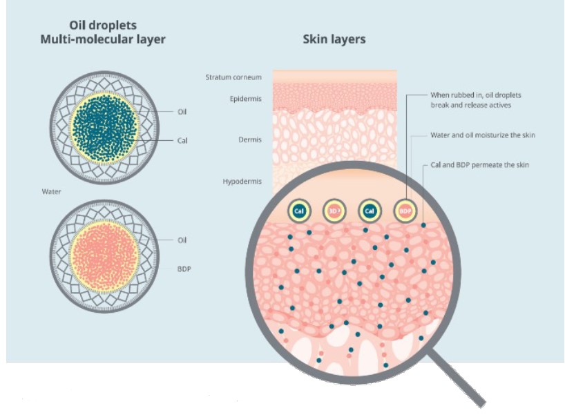 El efecto dominó de la psoriasis 11 Fig 11 Tecnologia PAD