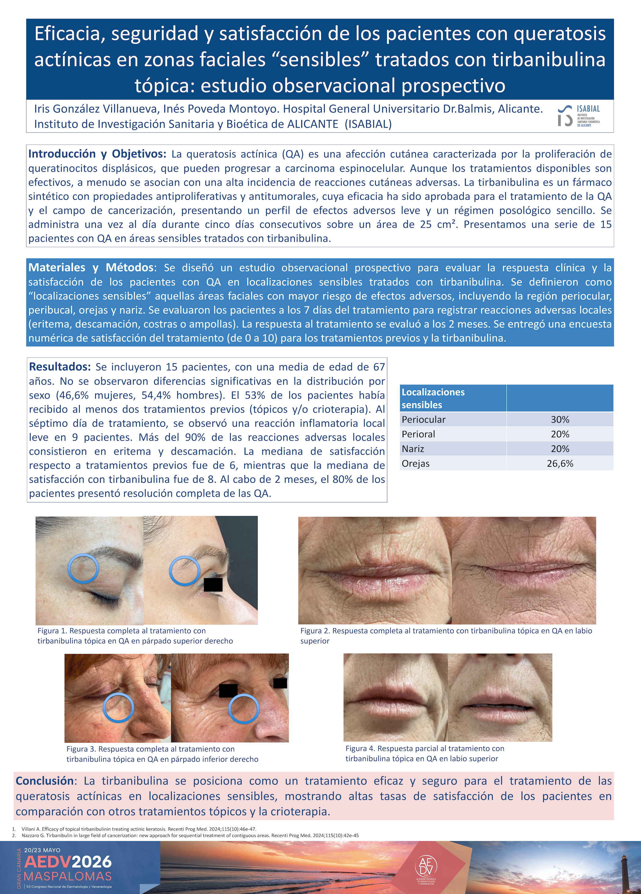 Eficacia, seguridad y satisfacción de los pacientes con queratosis actínicas en zonas faciales "sensibles" tratados con tirbanibulina tópica: estudio observacional prospectivo