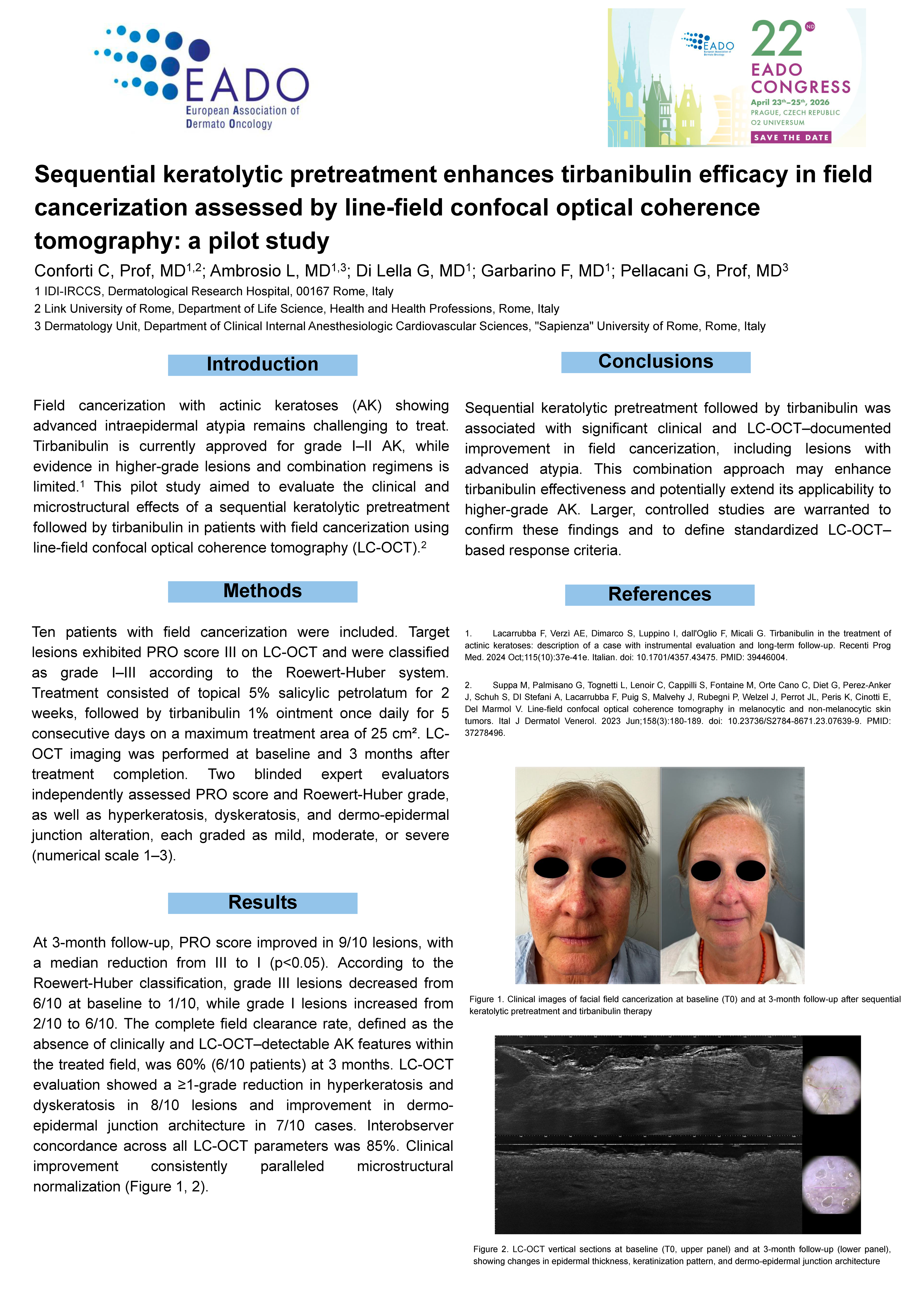 Sequential keratolytic pretreatment enhances tirbanibulin efficacy in field cancerization assessed by line-field confocal optical coherence tomography: a pilot studv
