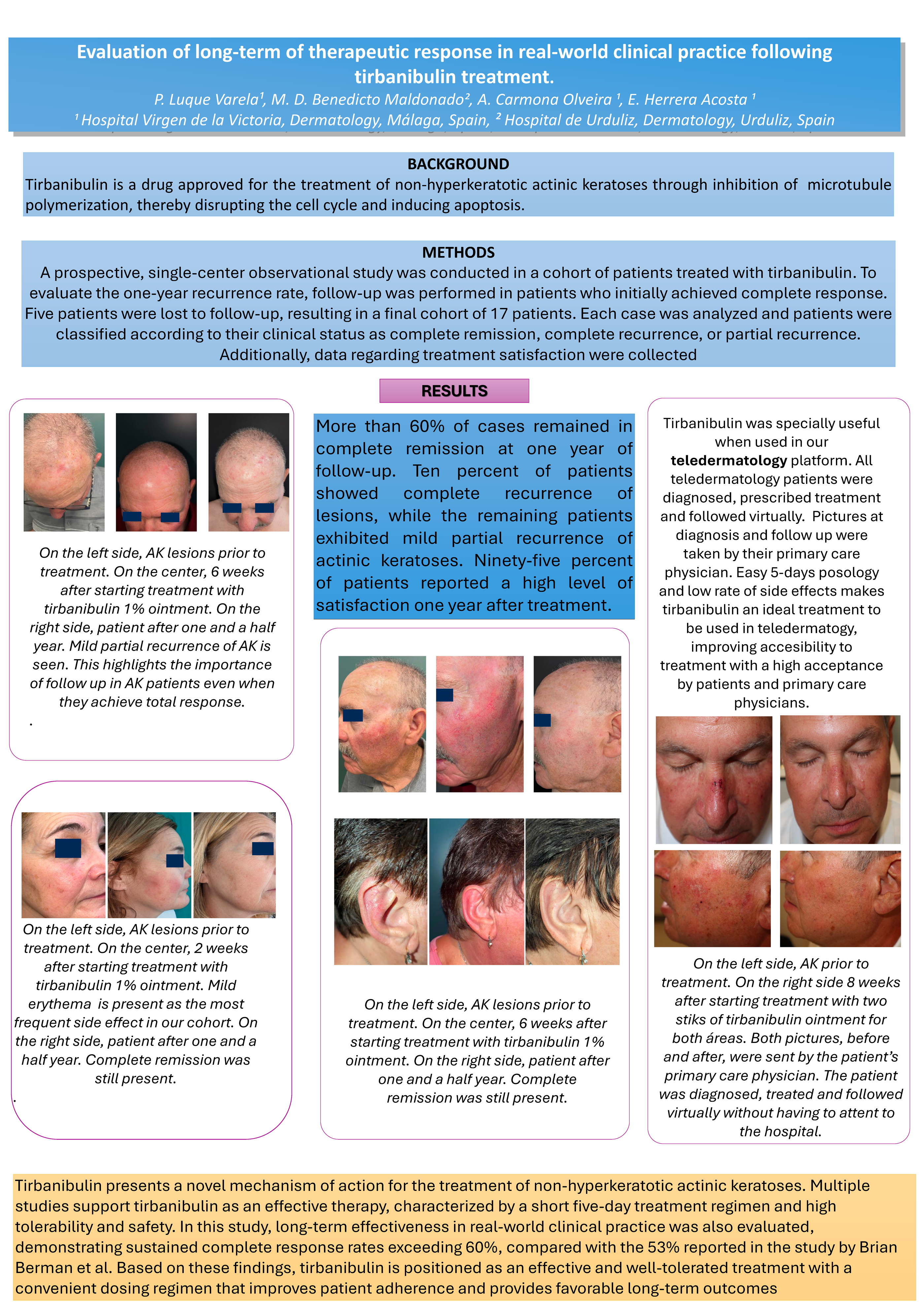 Sustained real-world effectiveness of tirbanibulin1% for actinic keratoses in solid organ transplant recipients